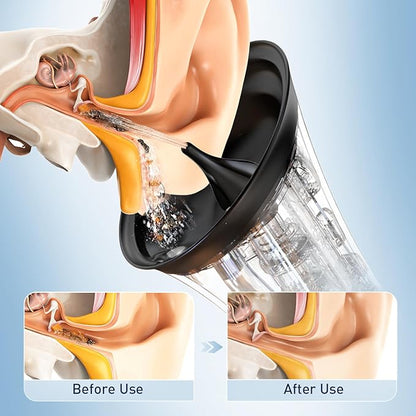 Hear Comes the Savings! Instantly clear your ears with Voldic™ — now 50% OFF for our Mid-Year Mega Sale. FDA-cleared, doctor-recommended, and ready for every family.